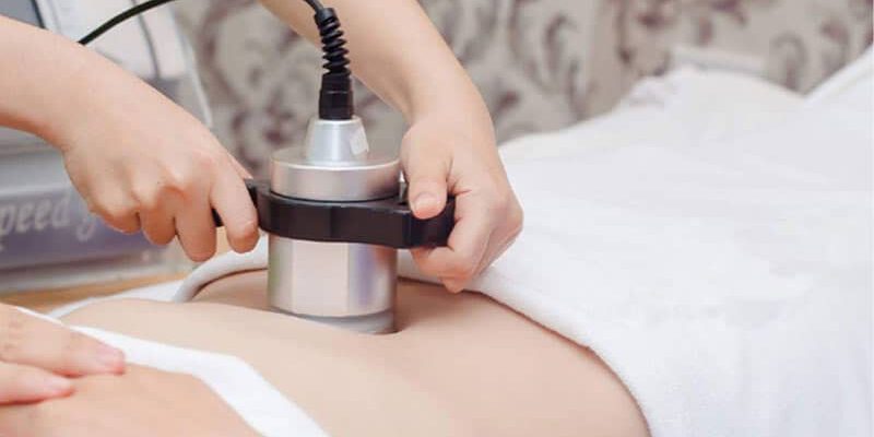 giam beo bang Radio Frequency